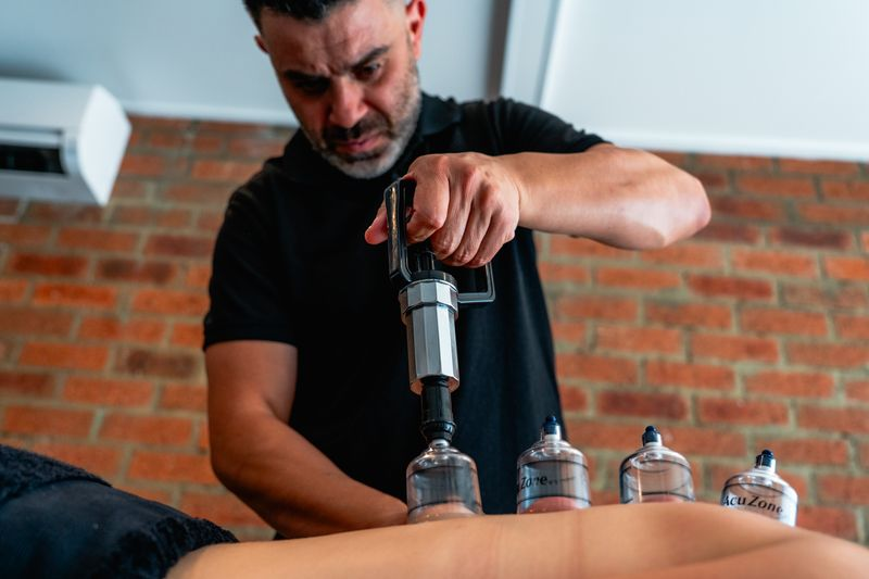 Myofascial cupping therapy at Core Therapy