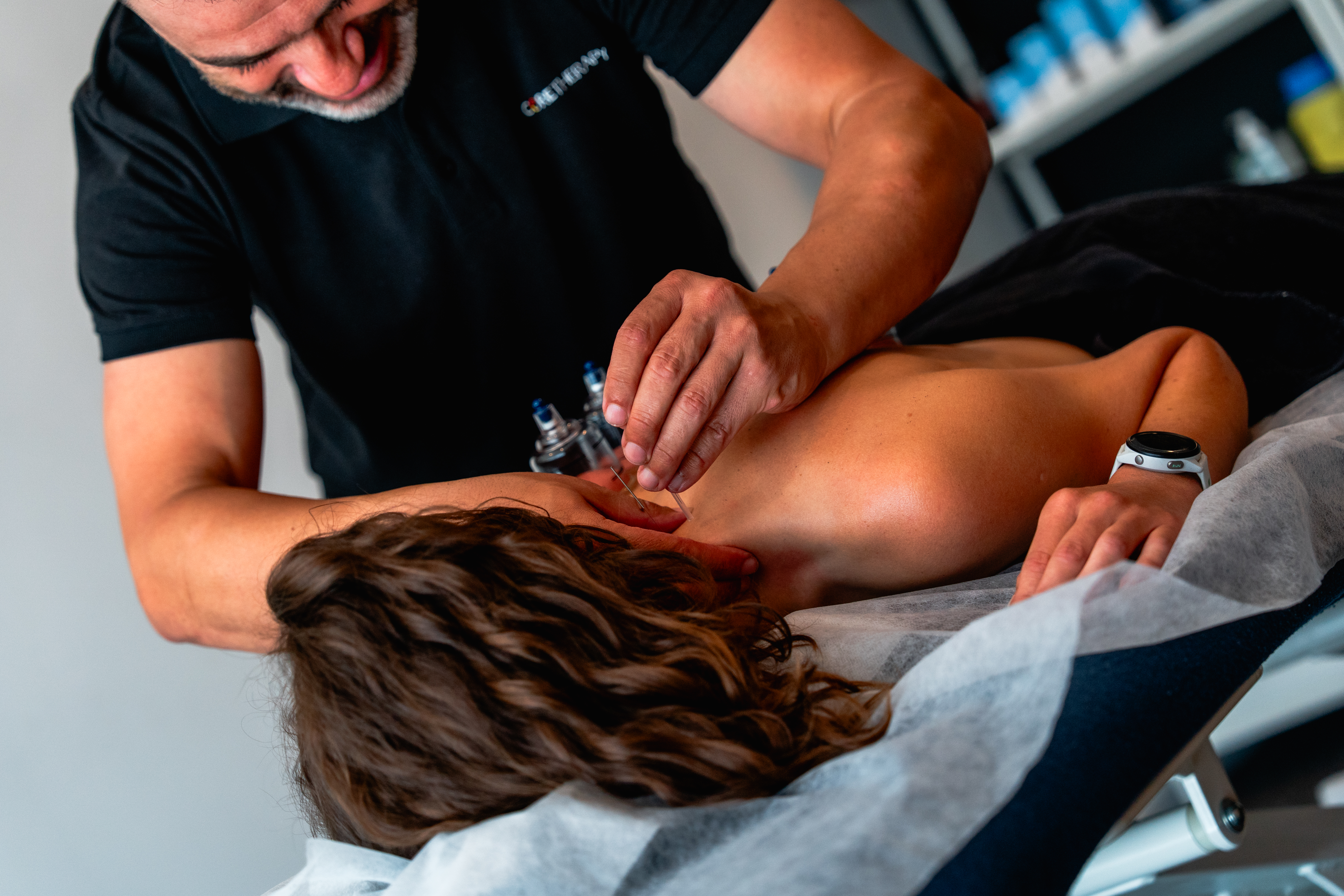 Myofascial Dry Needling